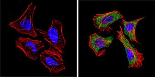 CD26 Antibody in Immunocytochemistry (ICC/IF)