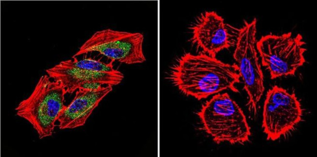 HSP70 Antibody in Immunocytochemistry (ICC/IF)