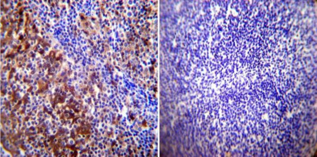 HSP70 Antibody in Immunohistochemistry (Paraffin) (IHC (P))