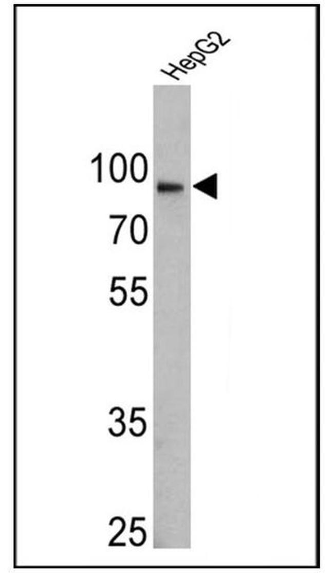 Calnexin Antibody in Western Blot (WB)