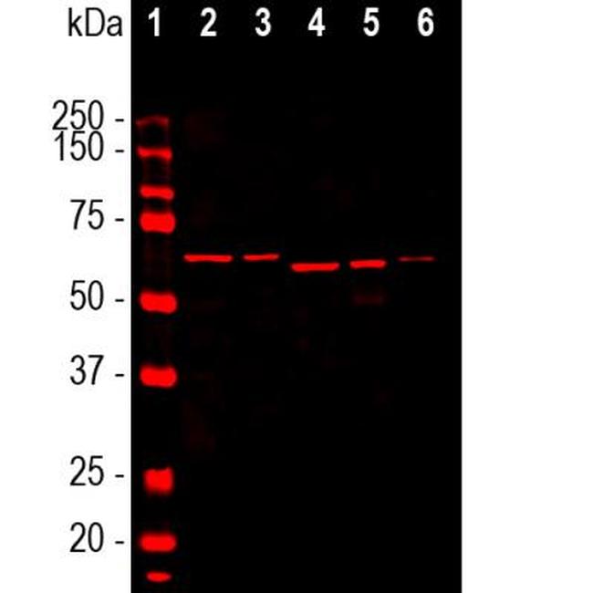 alpha Internexin Antibody in Western Blot (WB)