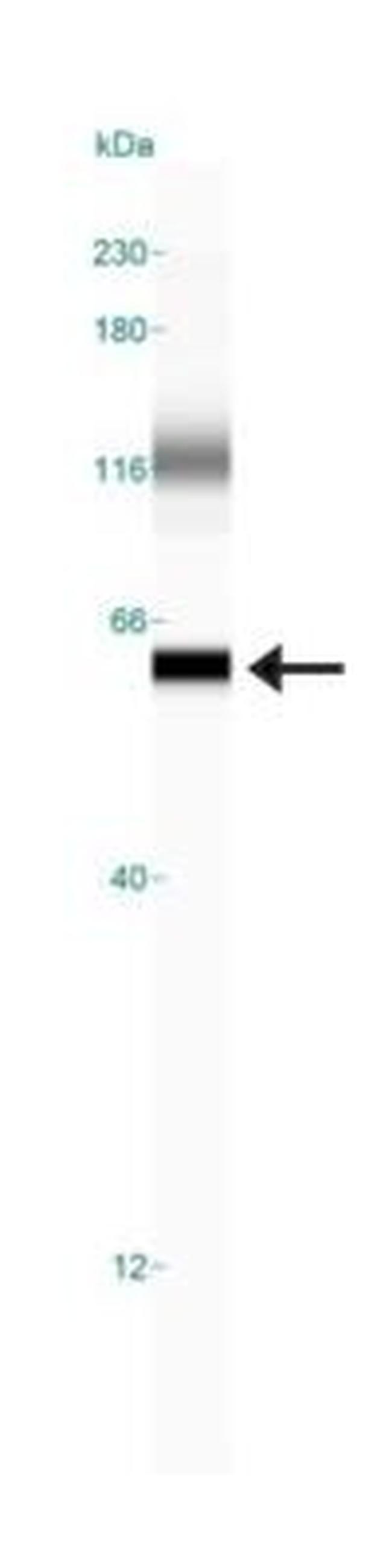 alpha Internexin Antibody in Western Blot (WB)