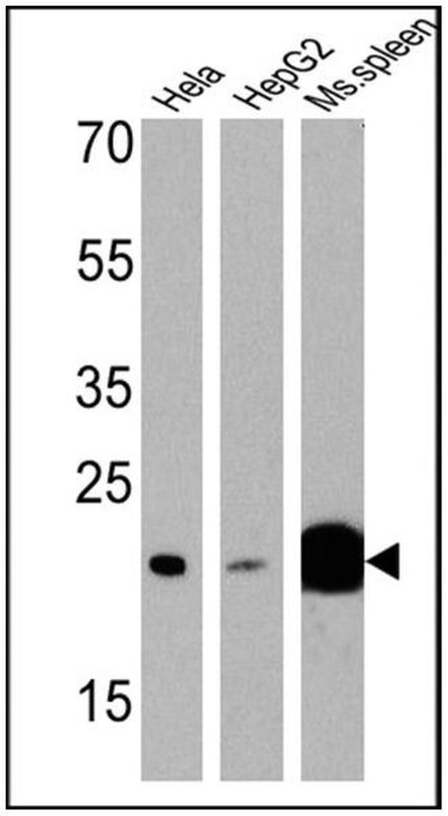 p23 Antibody in Western Blot (WB)