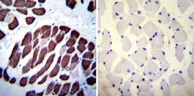 SERCA1 ATPase Antibody in Immunohistochemistry (Paraffin) (IHC (P))