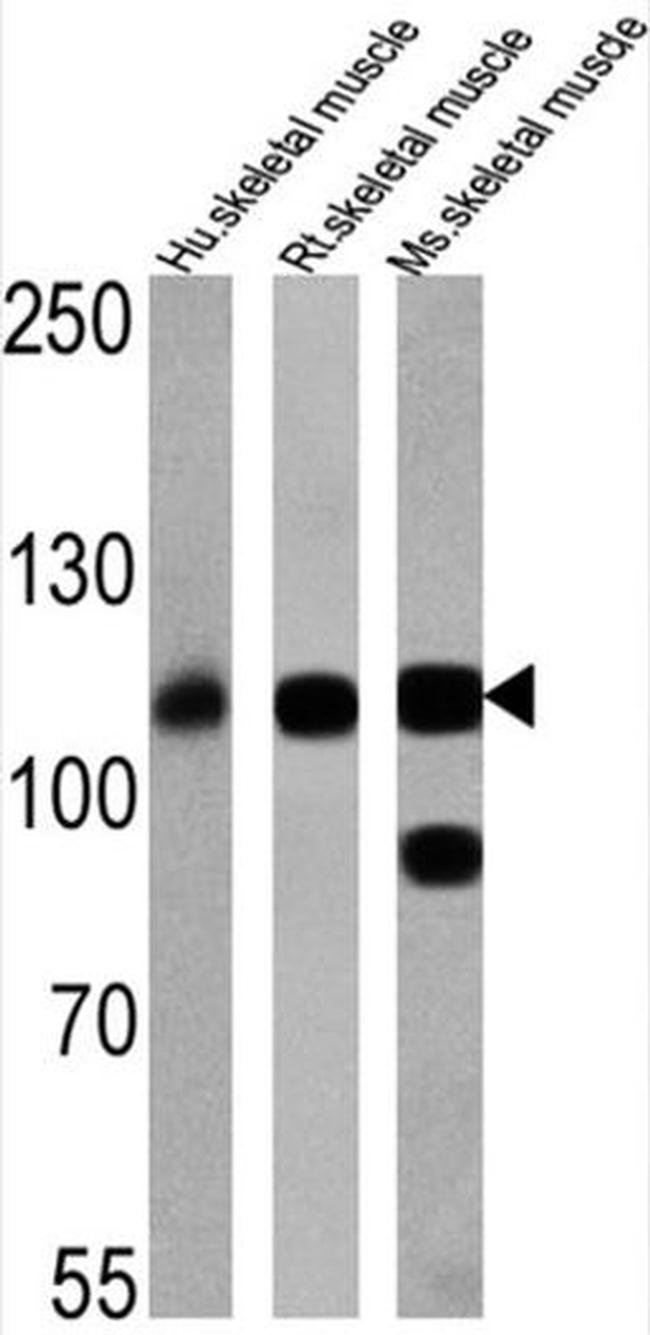 SERCA1 ATPase Antibody in Western Blot (WB)