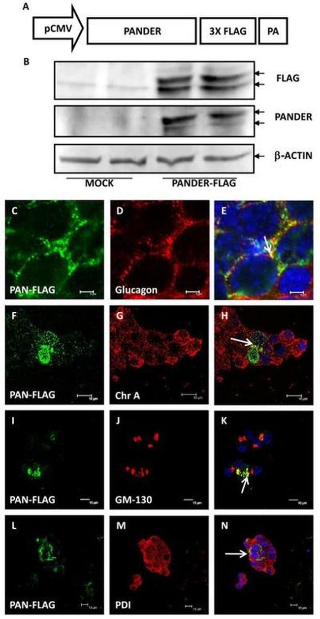 PDI Antibody in Immunohistochemistry (IHC)