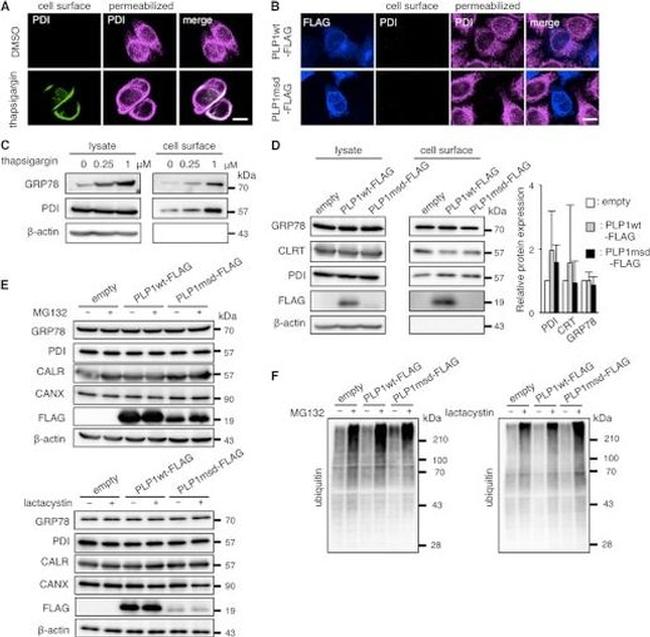 PDI Antibody in Western Blot, Immunocytochemistry (WB, ICC/IF)