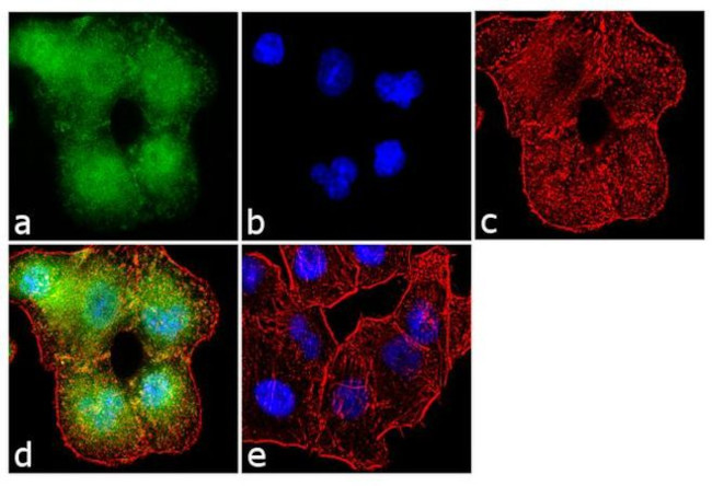 Aggrecan Antibody in Immunocytochemistry (ICC/IF)