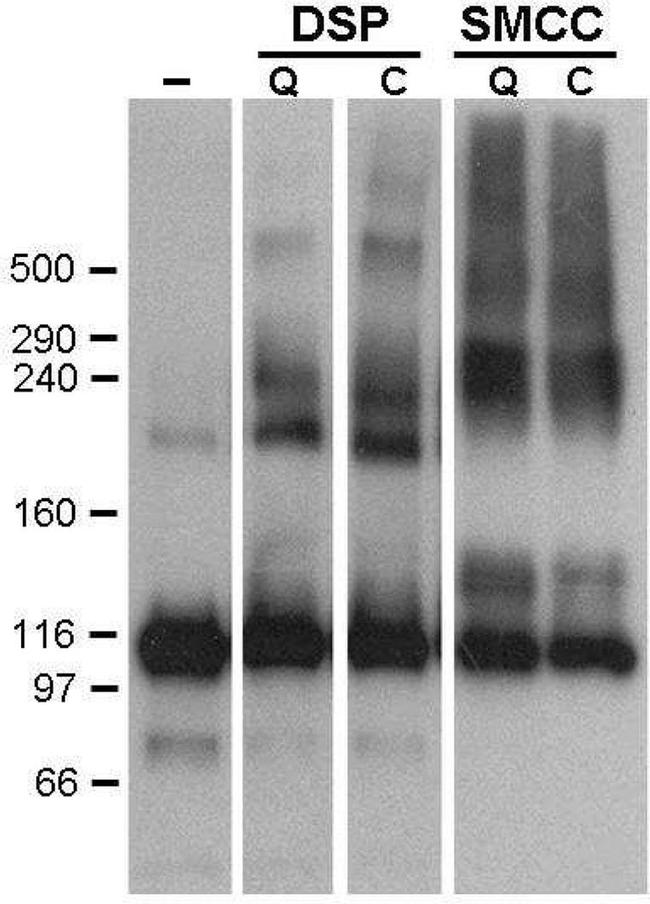 SERCA1 ATPase Antibody in Western Blot (WB)