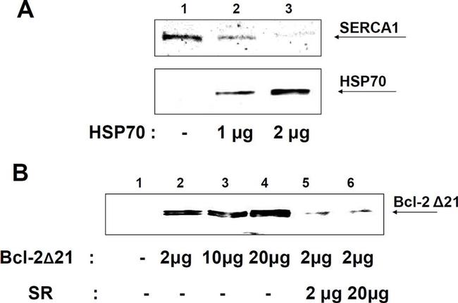 SERCA1 ATPase Antibody in Western Blot (WB)