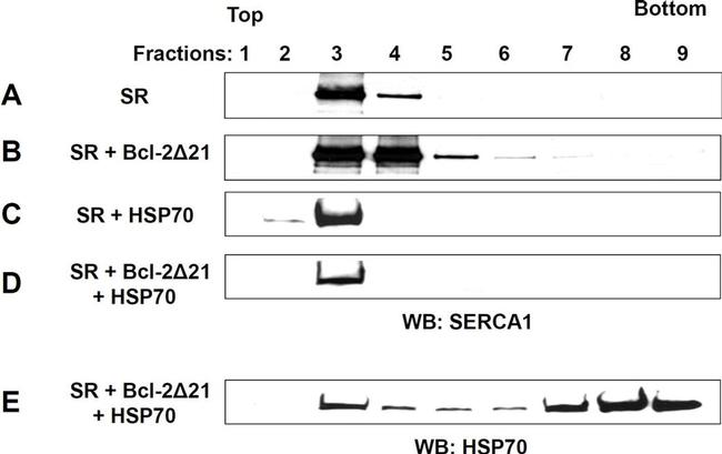 SERCA1 ATPase Antibody in Western Blot (WB)