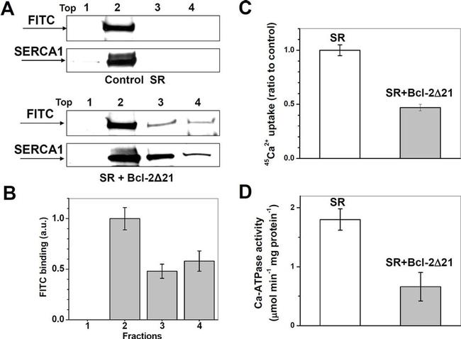 SERCA1 ATPase Antibody in Western Blot (WB)