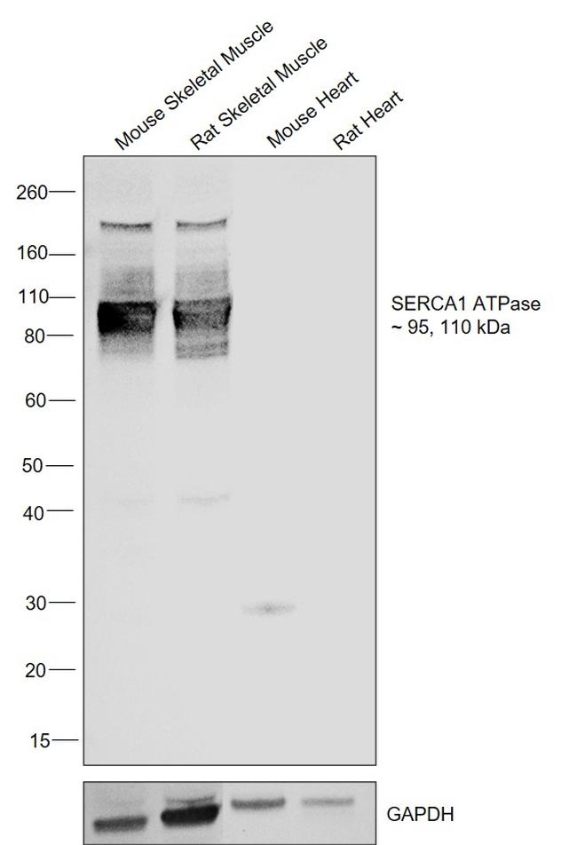 SERCA1 ATPase Antibody in Western Blot (WB)