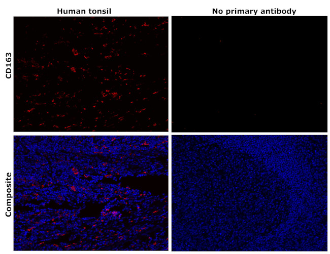 CD163 Antibody in Immunohistochemistry (Paraffin) (IHC (P))