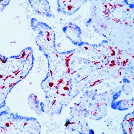 CD163 Antibody in Immunohistochemistry (Paraffin) (IHC (P))