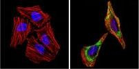 Alpha-Smooth Muscle Actin Antibody in Immunocytochemistry (ICC/IF)