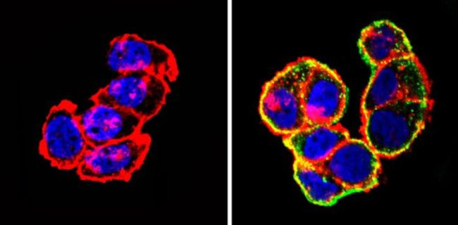 Actin Antibody in Immunocytochemistry (ICC/IF)