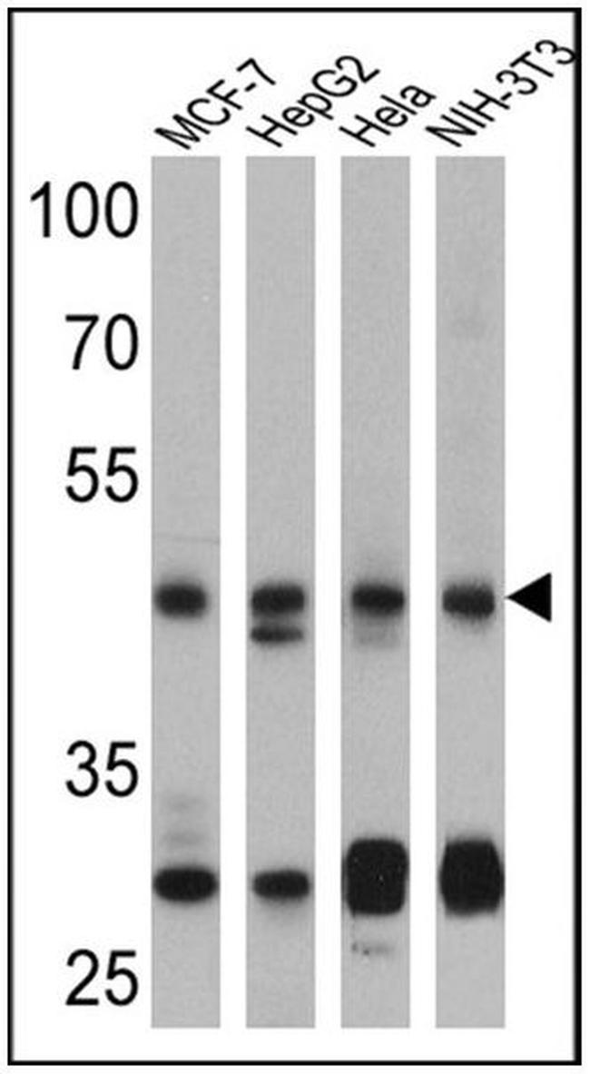 PTEN Antibody in Western Blot (WB)