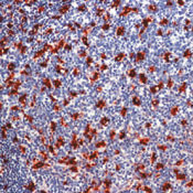 CD68 Antibody in Immunohistochemistry (Paraffin) (IHC (P))