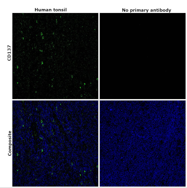 CD137 Antibody in Immunohistochemistry (Paraffin) (IHC (P))