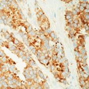 MVP Antibody in Immunohistochemistry (Paraffin) (IHC (P))