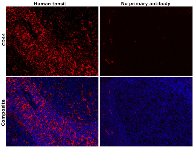 CD44 Antibody in Immunohistochemistry (Paraffin) (IHC (P))