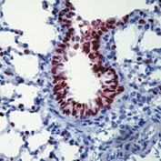 Nkx2.1 Antibody in Immunohistochemistry (Paraffin) (IHC (P))