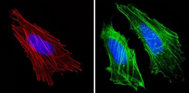 Actin Muscle Antibody in Immunocytochemistry (ICC/IF)