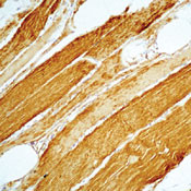 Actin Muscle Antibody in Immunohistochemistry (Paraffin) (IHC (P))