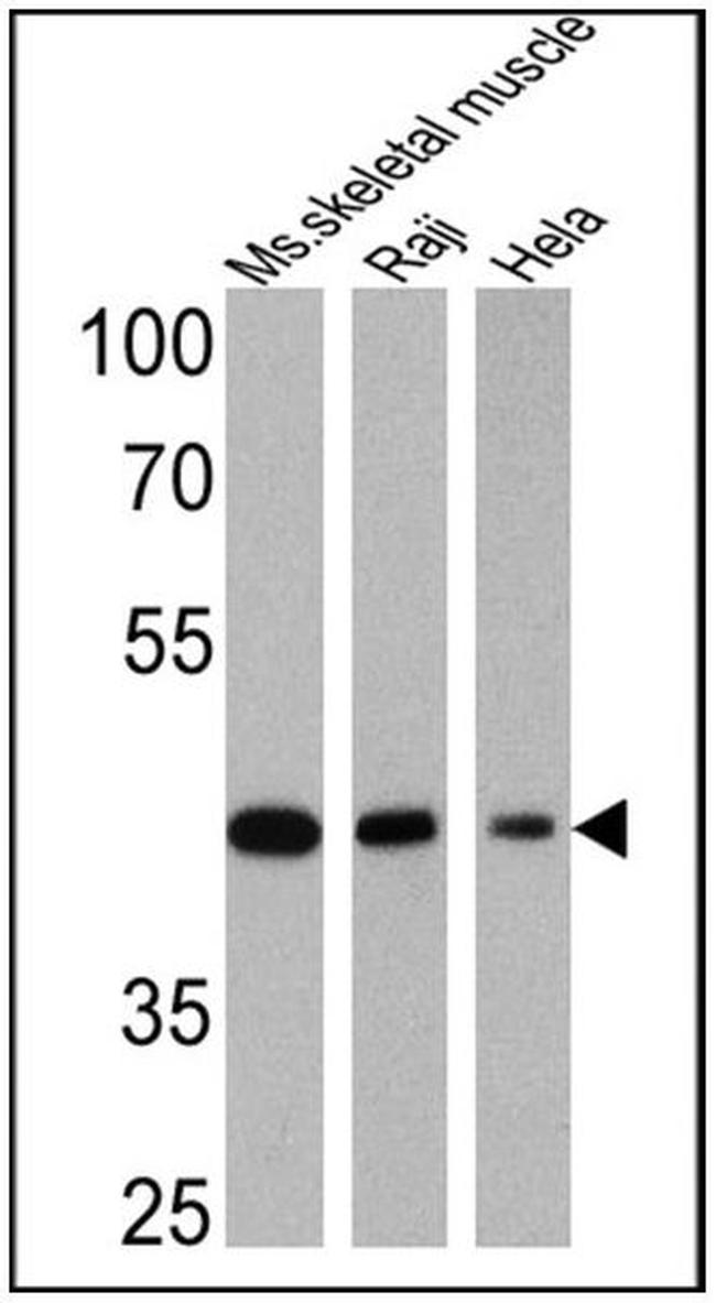 Actin Muscle Antibody in Western Blot (WB)