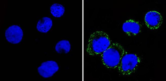 CD36 Antibody in Immunocytochemistry (ICC/IF)