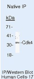 CDKN2C Antibody in Immunoprecipitation (IP)
