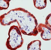 c-Abl Antibody in Immunohistochemistry (Paraffin) (IHC (P))