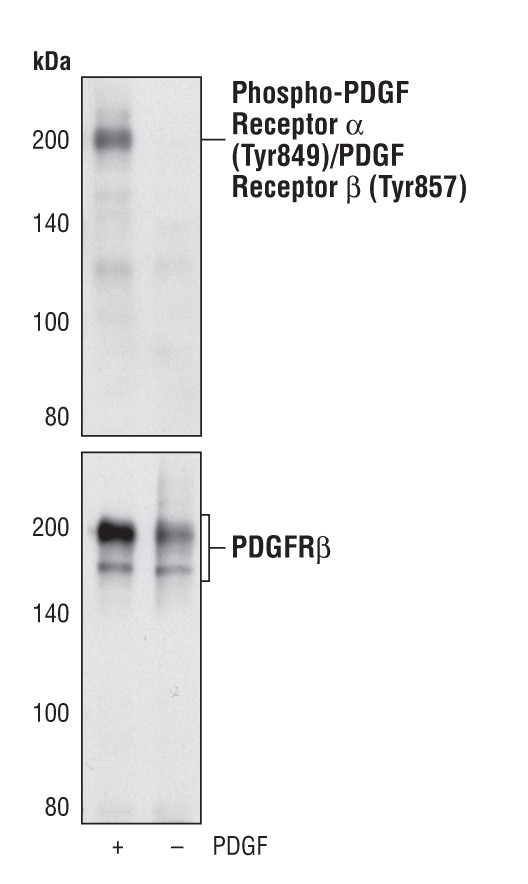 Phospho-PDGFRA/PDGFRB (Tyr849, Tyr857) Antibody in Western Blot (WB)