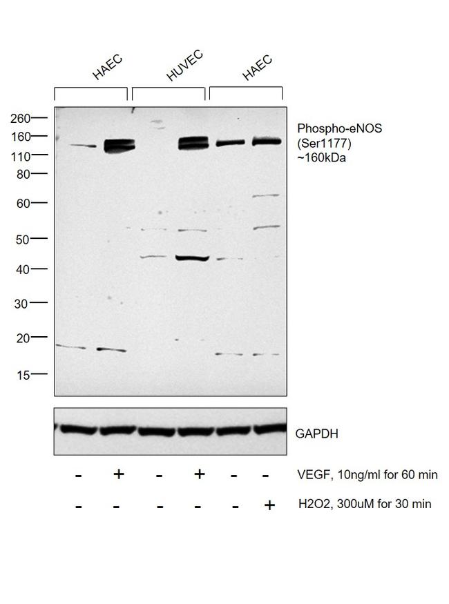 Phospho-eNOS (Ser1177) Antibody in Western Blot (WB)