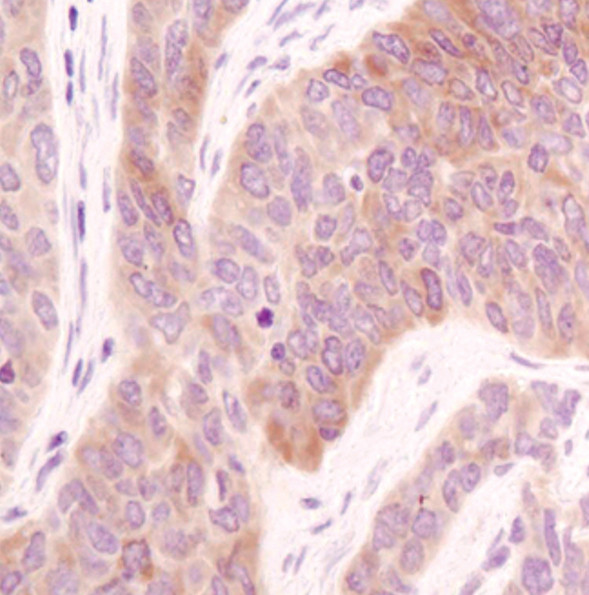 Acetyl-CoA Carboxylase Antibody in Immunohistochemistry (Paraffin) (IHC (P))