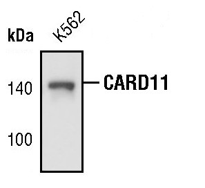 CARD11 Antibody in Western Blot (WB)