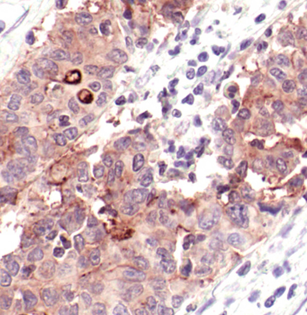 CEA Antibody in Immunohistochemistry (Paraffin) (IHC (P))