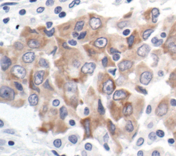 Bcl-xL Antibody in Immunohistochemistry (Paraffin) (IHC (P))