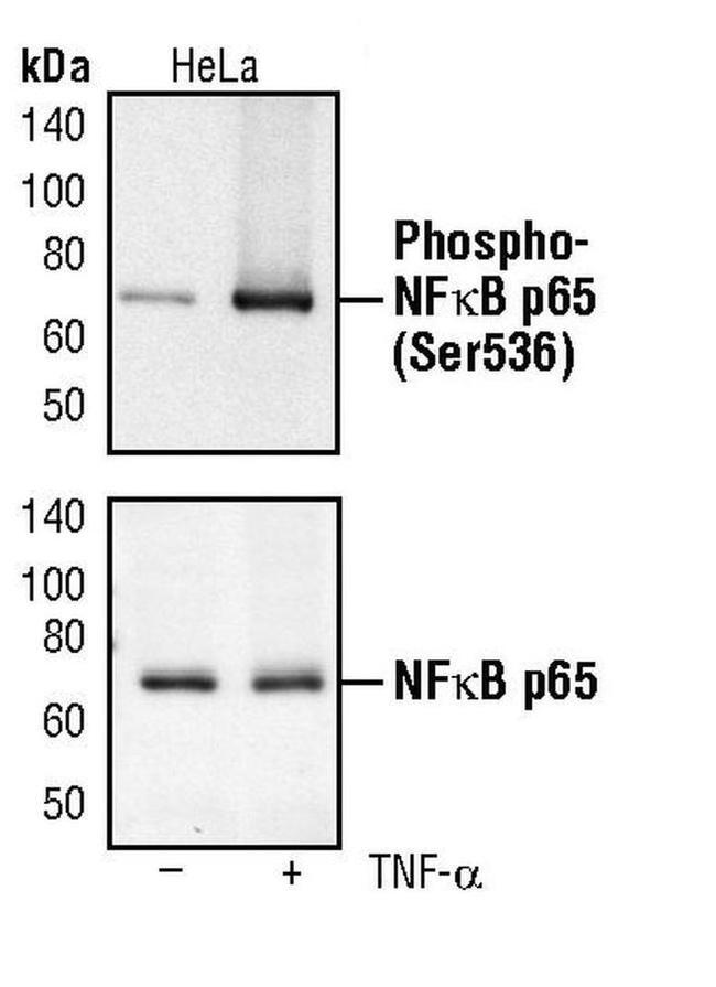 Phospho-NFkB P65 (Ser536) Monoclonal Antibody (T.849.2) (MA5-15160)