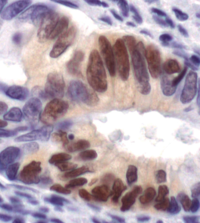 Phospho-ERK1/ERK2 (Thr202, Tyr204) Antibody in Immunohistochemistry (Paraffin) (IHC (P))