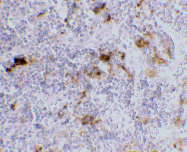 DC-SIGN Antibody in Immunohistochemistry (IHC)