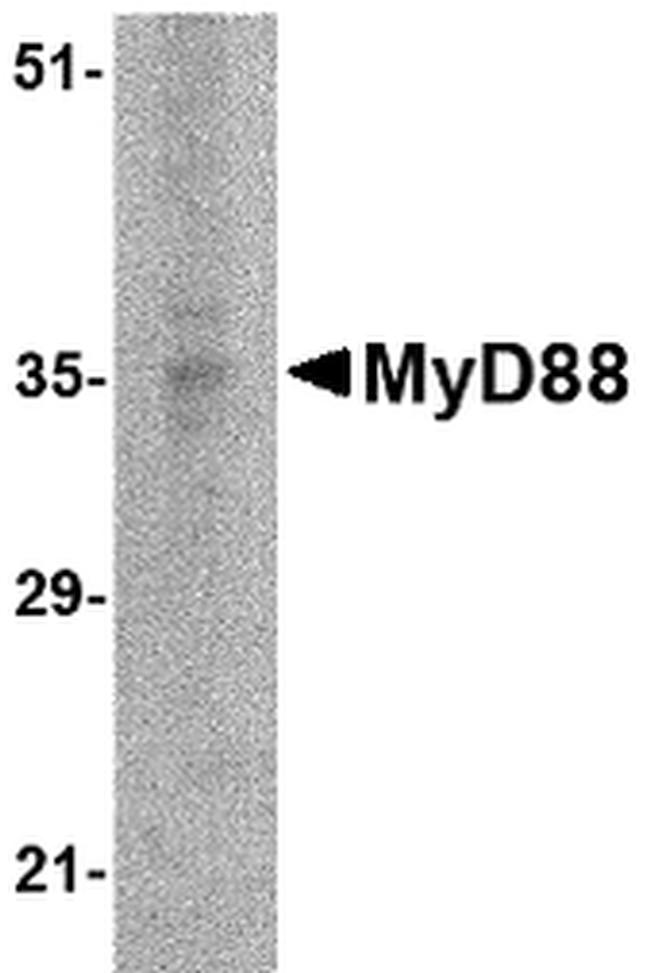 MyD88 Antibody in Western Blot (WB)