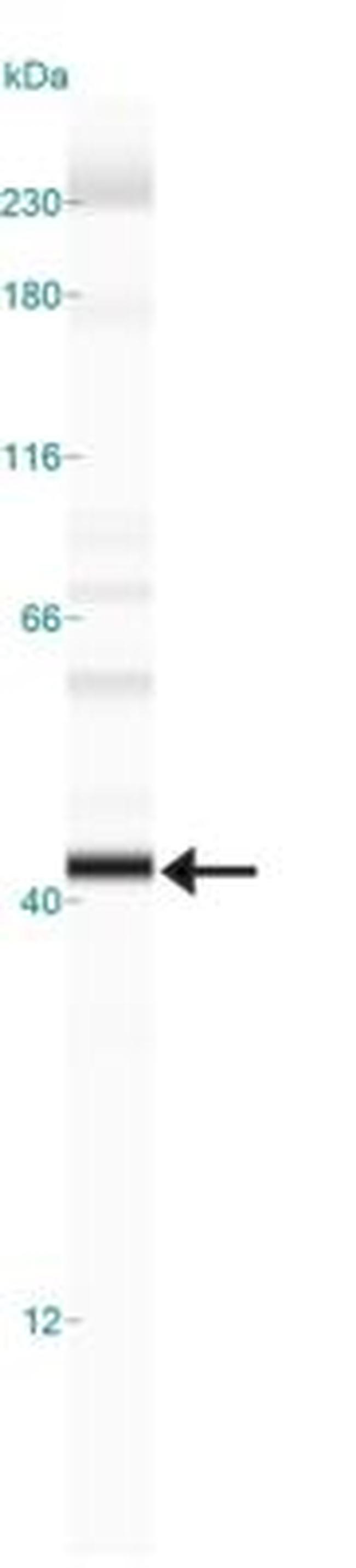 PHD2 Antibody in Western Blot (WB)