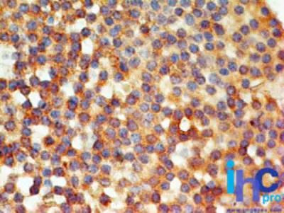 TLR6 Antibody in Immunohistochemistry (Paraffin) (IHC (P))