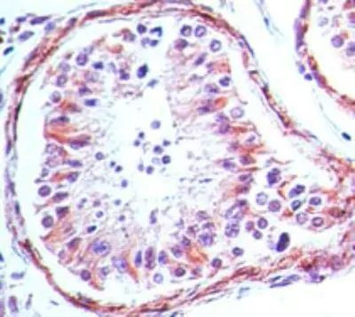 TLR4 Antibody in Immunohistochemistry (Paraffin) (IHC (P))