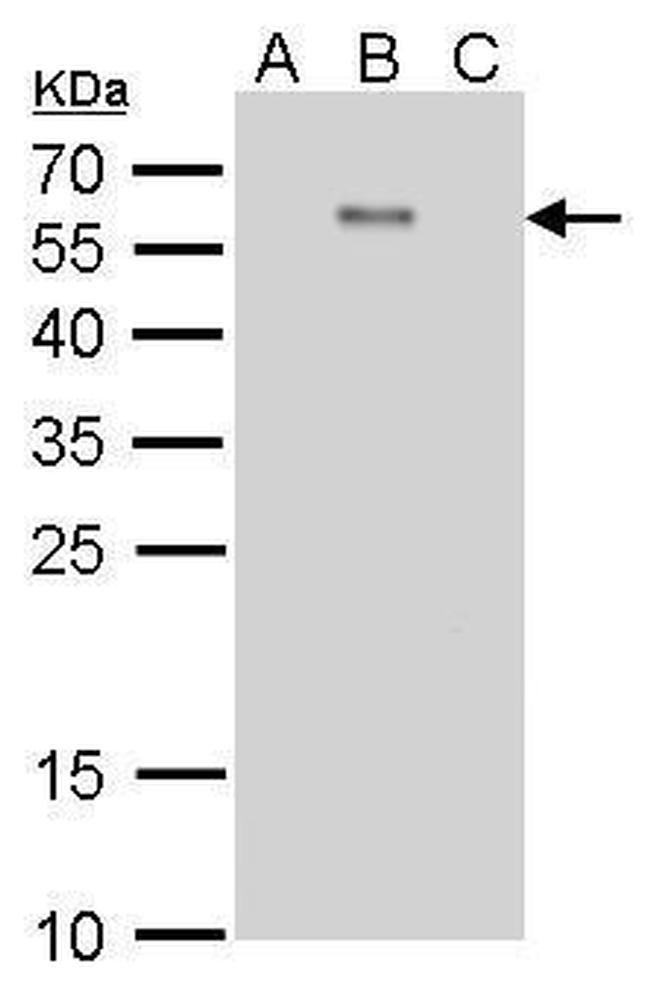 Dengue Virus Type 2 Envelope Antibody in Western Blot (WB)