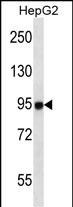 MASTL Antibody in Western Blot (WB)