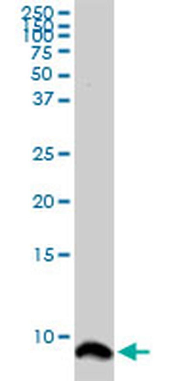 ATOX1 Antibody in Western Blot (WB)