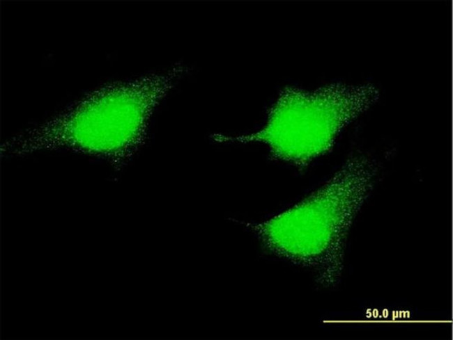 MEK5 Antibody in Immunocytochemistry (ICC/IF)